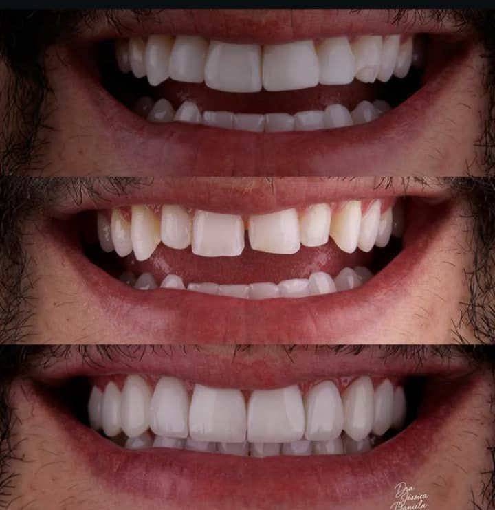 Planejamento com mock-up, antes e depois